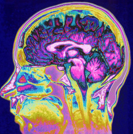 Brain-scan