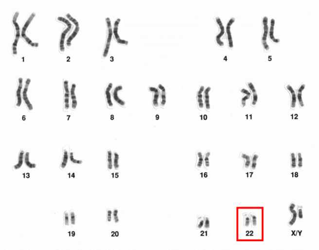 Human_male_karyotpe_high_resolution_-_Chromosome_22