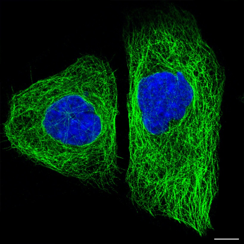 microtubules__4__21431__1_blue_green