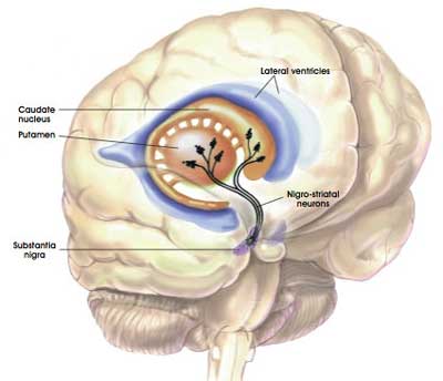 brain-nigrostriatal-parkinsons