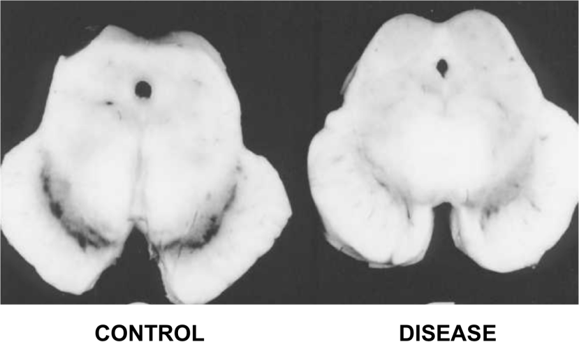 d1ea3d21c36935b85043b3b53f2edb1f87ab7fa6