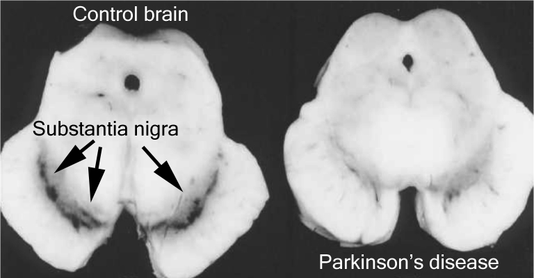 d1ea3d21c36935b85043b3b53f2edb1f87ab7fa6