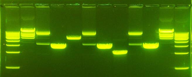 agarose-gel-electrophoresis-dna