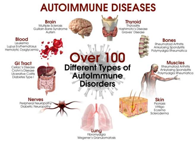 AutoImmune-1024x768