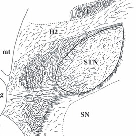 Figure-3-Schematic-drawings-showing-the-5-HT-innervation-of-the-human-subthalamic