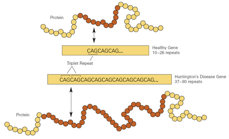 huntington_s_disease