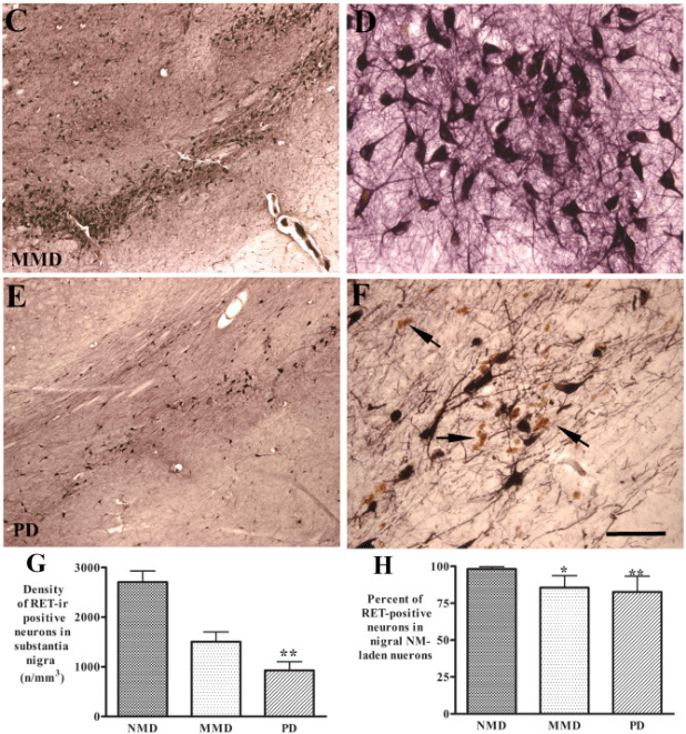 Ret Level What is GDNF without RET? – The Science of Parkinson's
